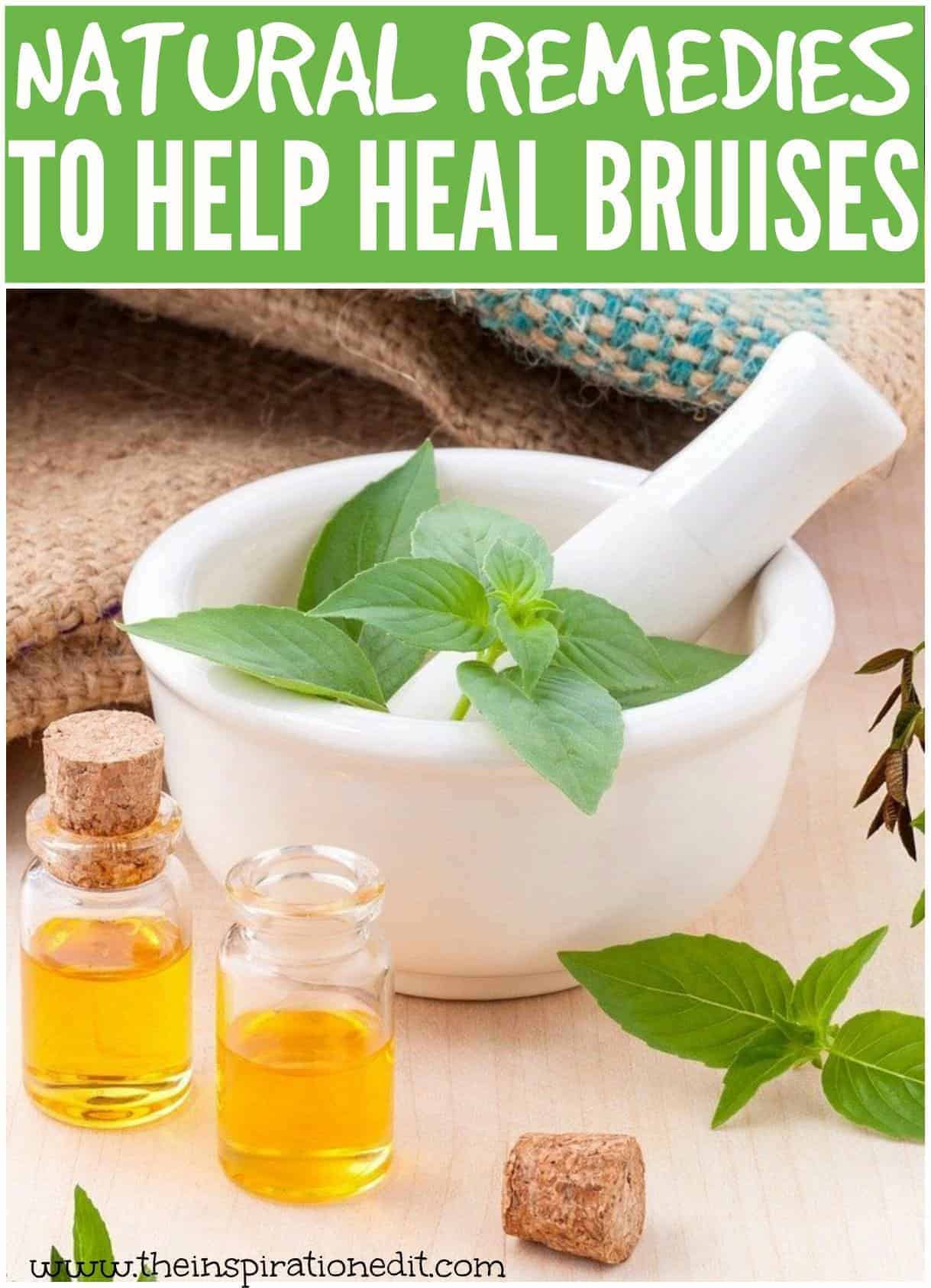 How To Get Rid Of Bruises Using Natural Remedies