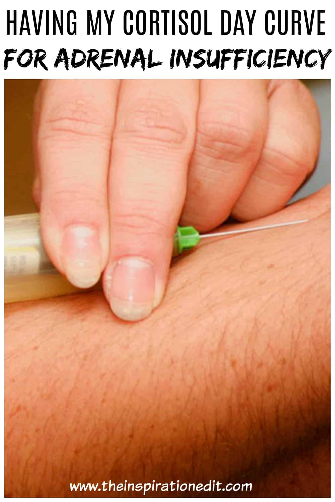 cortisol day curve test for adrenal insufficiency