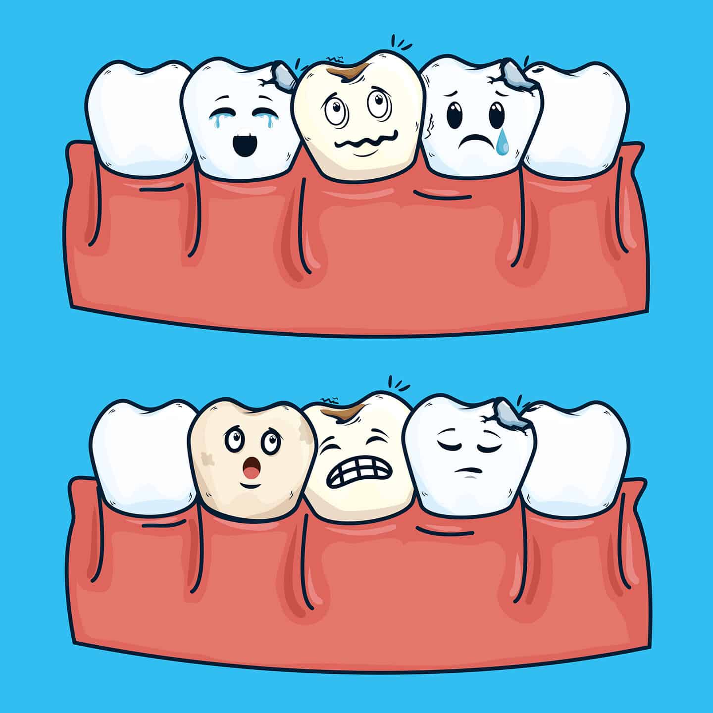 crowded teeth