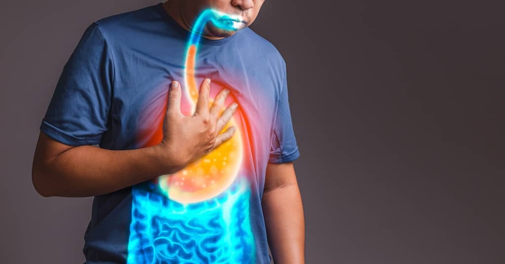 Lifestyle Changes To Manage GERD.