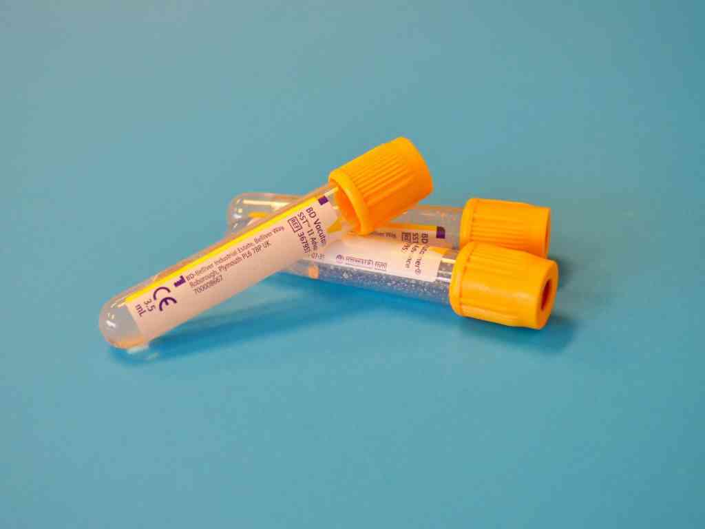 The Cost Of Cord Blood Banking