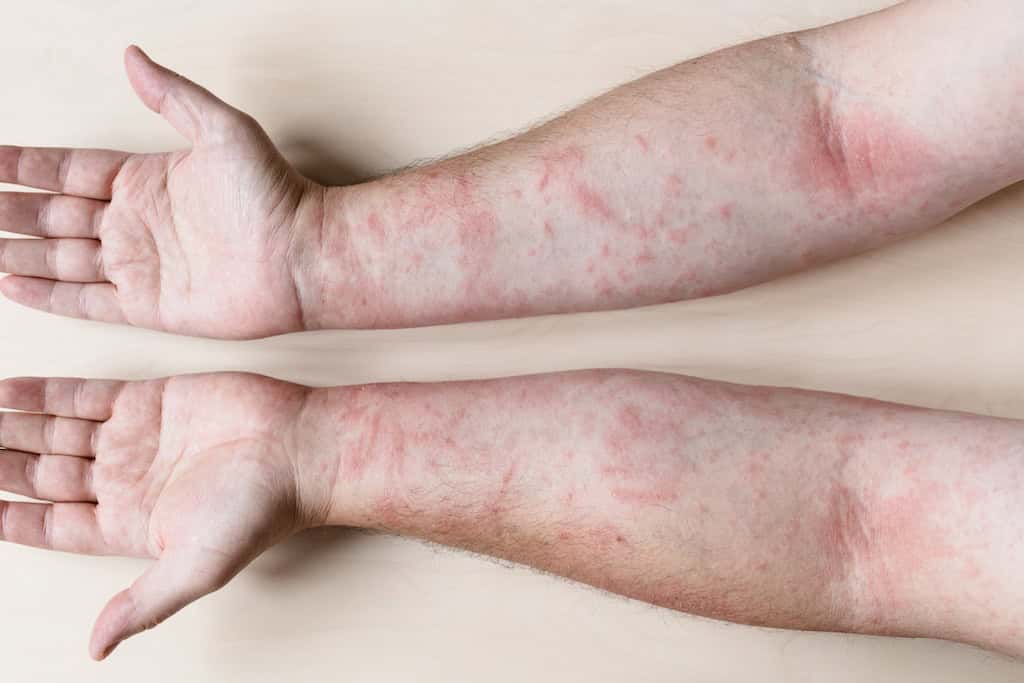 Things That Can Trigger Allergy.